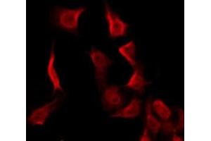 ABIN6275971 staining HeLa by IF/ICC.