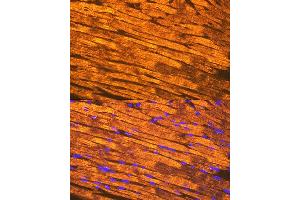 Immunofluorescence analysis of mouse heart using Tropomyosin 1 Rabbit mAb (ABIN7271013) at dilution of 1:100 (40x lens).