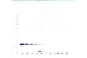 Image no. 2 for anti-Vascular Endothelial Growth Factor A (VEGFA) antibody (ABIN465336) (VEGFA anticorps)