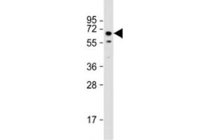 Western blot testing of mouse testis lysate with TOR1AIP1 antibody at 1:2000. (TOR1AIP1 anticorps  (AA 42-76))