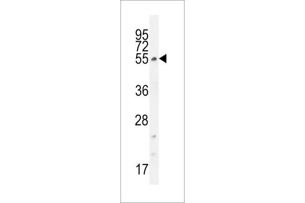 CCDC61 anticorps  (N-Term)