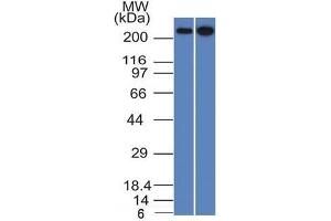 Western Blot Analysis of HeLa and 293 cell lysates using Spectrin beta III Mouse Monoclonal Antibody (SPTBN2/1582).
