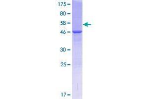 Image no. 1 for COMM Domain Containing 4 (COMMD4) (AA 1-199) protein (GST tag) (ABIN1350021)