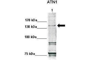 WB Suggested Anti-ATN1 Antibody  Positive Control: Lane1: 30ug human fibroblasts  Primary Antibody Dilution :  1:500 Secondary Antibody :  Anti-rabbit-HRP  Secondry Antibody Dilution :  1:1000 Submitted by: Anonymous (Atrophin 1 anticorps  (N-Term))