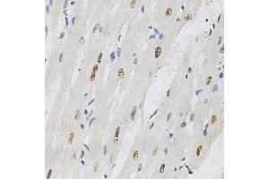 Immunohistochemistry of paraffin-embedded rat heart using KPNA4 Antibody (ABIN5971058) at dilution of 1/200 (40x lens). (KPNA4 anticorps)