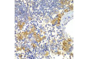 Immunohistochemistry of paraffin-embedded rat spleen using NOTCH1 antibody (ABIN5995370) at dilution of 1/100 (40x lens). (Notch1 anticorps)