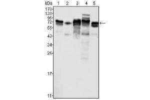 Western Blotting (WB) image for anti-Metadherin (MTDH) antibody (ABIN1108306) (MTDH anticorps)