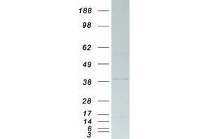 Validation with Western Blot