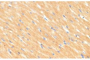 Immunohistochemistry of paraffin-embedded Rat heart using MYBPC3 Polyclonal Antibody at dilution of 1:100 (40x lens). (MYBPC3 anticorps)