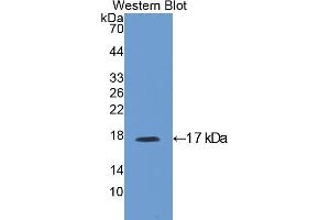 Western blot analysis of the recombinant protein. (IGFBP3 anticorps  (AA 137-274))
