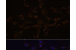 Immunofluorescence analysis of C6 cells using RGS4 Polyclonal Antibody at dilution of 1:100. (RGS4 anticorps)