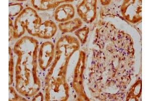IHC image of ABIN7148257 diluted at 1:100 and staining in paraffin-embedded human kidney tissue performed on a Leica BondTM system.
