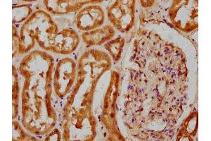 IHC image of ABIN7148257 diluted at 1:100 and staining in paraffin-embedded human kidney tissue performed on a Leica BondTM system. (COL4a5 anticorps  (AA 1184-1235))