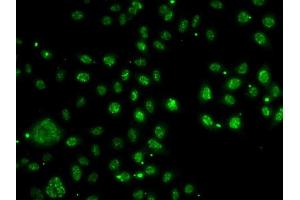 Immunofluorescence analysis of A-549 cells using LDLR antibody (ABIN6127366, ABIN6143131, ABIN6143132 and ABIN6222897).