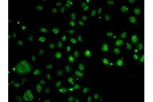 Immunofluorescence analysis of A-549 cells using LDLR antibody (ABIN6127366, ABIN6143131, ABIN6143132 and ABIN6222897). (LDLRAP1 anticorps  (AA 59-308))