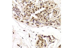 Immunohistochemistry of paraffin-embedded Human mammary gland using SNRPA antibody at dilution of 1:100 (x400 lens). (SNRPA1 anticorps)