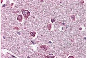 Anti-DPP10 antibody  ABIN1048507 IHC staining of human brain, cortex. (DPP10 anticorps  (Internal Region))