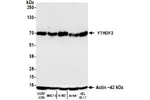 Western Blotting (WB) image for anti-YTH Domain Family, Member 2 (YTHDF2) (AA 300-350) antibody (ABIN7795701) (Recombinant YTHDF2 anticorps  (AA 300-350))