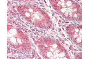 Human Colon: Formalin-Fixed, Paraffin-Embedded (FFPE).