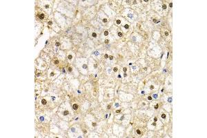 Immunohistochemistry of paraffin-embedded human liver injury using RAD9A antibody (ABIN5970971) at dilution of 1/200 (40x lens). (RAD9A anticorps)