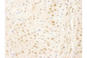 anti-Cyclin C (CCNC) (AA 244-294) antibody