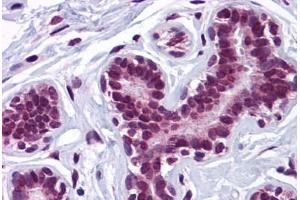 Human Breast: Formalin-Fixed, Paraffin-Embedded (FFPE)