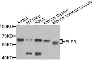 Western blot analysis of extracts of various cells, using ELP3 antibody. (ELP3/KAT9 anticorps)
