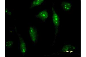 Immunofluorescence of monoclonal antibody to SOLH on HeLa cell. (Calpain 15/SOLH anticorps  (AA 993-1086))