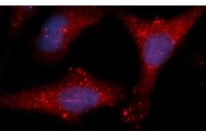 Immunofluorescence (IF) image for anti-Lactate Dehydrogenase B (LDHB) (AA 1-334) antibody (APC) (ABIN5565783) (LDHB anticorps  (AA 1-334) (APC))