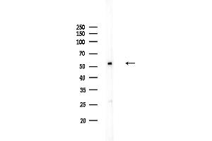 Western blot analysis of lysates from COLO205 cells, using NDUFV1 Antibody at 1/1000 dilution.