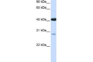 WB Suggested Anti-GCDH Antibody Titration:  0. (GCDH anticorps  (N-Term))