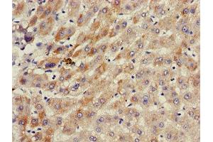 Immunohistochemistry of paraffin-embedded human liver tissue using ABIN7143187 at dilution of 1:100 (ACAD11 anticorps  (AA 225-388))
