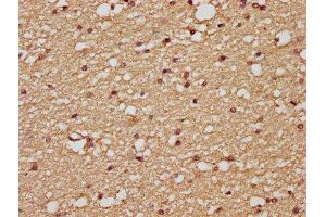 IHC image of ABIN7175125 diluted at 1:200 and staining in paraffin-embedded human brain tissue performed on a Leica BondTM system. (PLAUR anticorps  (AA 23-305))