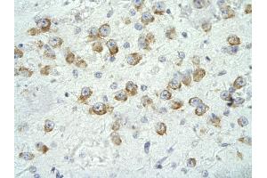 Rabbit Anti-MED17 Antibody       Paraffin Embedded Tissue:  Human neural cell   Cellular Data:  Epithelial cells of renal tubule  Antibody Concentration:   4. (MED17 anticorps  (N-Term))