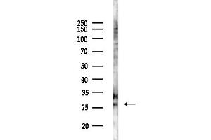 Western blot analysis of lysates from COLO205 cells(UV 30 min treatment), using IGFBP1 Antibody at 1/1000 dilution.
