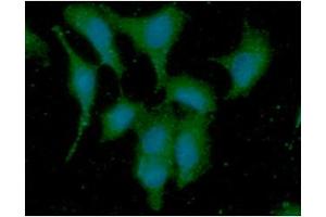 ICC/IF analysis of DYNLL in A549 cells line, stained with DAPI (Blue) for nucleus staining and monoclonal anti-human DYNLL antibody (1:100) with goat anti-mouse IgG-Alexa fluor 488 conjugate (Green). (DYNLL1 anticorps)