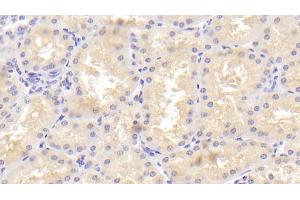 Detection of TANK in Human Kidney Tissue using Polyclonal Antibody to TRAF Family Member Associated NFKB Activator (TANK)