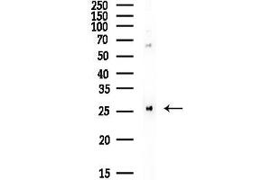 anti-rho GDP Dissociation Inhibitor (GDI) alpha (ARHGDIA) (N-Term) antibody