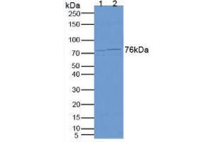 Figure. (CEA anticorps  (AA 93-221))