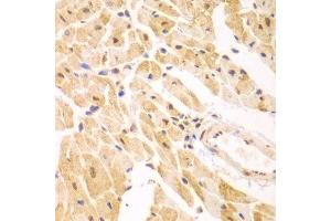 Immunohistochemistry of paraffin-embedded mouse heart using PSMD2 antibody.