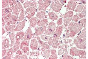 Rabbit Anti-PLA2G5 antibody  Formalin Fixed Paraffin Embedded Tissue: Human Heart Primary antibody Concentration: 1:100 Secondary Antibody: Donkey anti-Rabbit-Cy3 Secondary Antibody Concentration: 1:200 Magnification: 20x Exposure Time: 0.