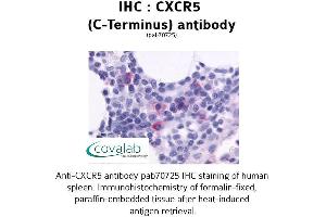 Image no. 1 for anti-Chemokine (C-X-C Motif) Receptor 5 (CXCR5) (C-Term) antibody (ABIN1733411) (CXCR5 anticorps  (C-Term))
