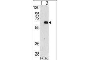 Western blot analysis of FR (arrow) using FR Antibody (C-term) (ABIN388938 and ABIN2850529). (AMFR anticorps  (AA 571-601))