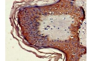 Immunohistochemistry of paraffin-embedded human skin tissue using ABIN7160462 at dilution of 1:100 (MNDA anticorps  (AA 84-233))