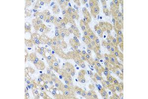 Immunohistochemistry of paraffin-embedded human liver injury using PRMT2 antibody at dilution of 1:100 (x40 lens). (PRMT2 anticorps)