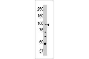 Western blot analysis of CPT1A polyclonal antibody  in Y-79 cell line lysate (35 ug/lane). (CPT1A anticorps  (C-Term))