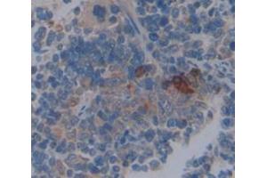 IHC-P analysis of spleen tissue, with DAB staining. (Coronin 1a anticorps  (AA 1-204))