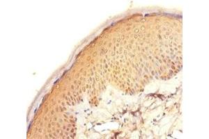 Immunohistochemistry of paraffin-embedded human skin tissue using ABIN7165631 at dilution of 1:100 (C11orf73 anticorps  (AA 1-197))