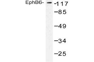 Western blot (WB) analysis of EphB6 antibody in extracts from COLO cells. (EPH Receptor B6 anticorps)