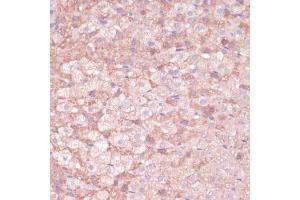 Immunohistochemistry of paraffin-embedded rat adrenal gland using CYP11B2 antibody (ABIN1679468, ABIN3015492, ABIN3015493 and ABIN6218533) at dilution of 1:100 (40x lens).